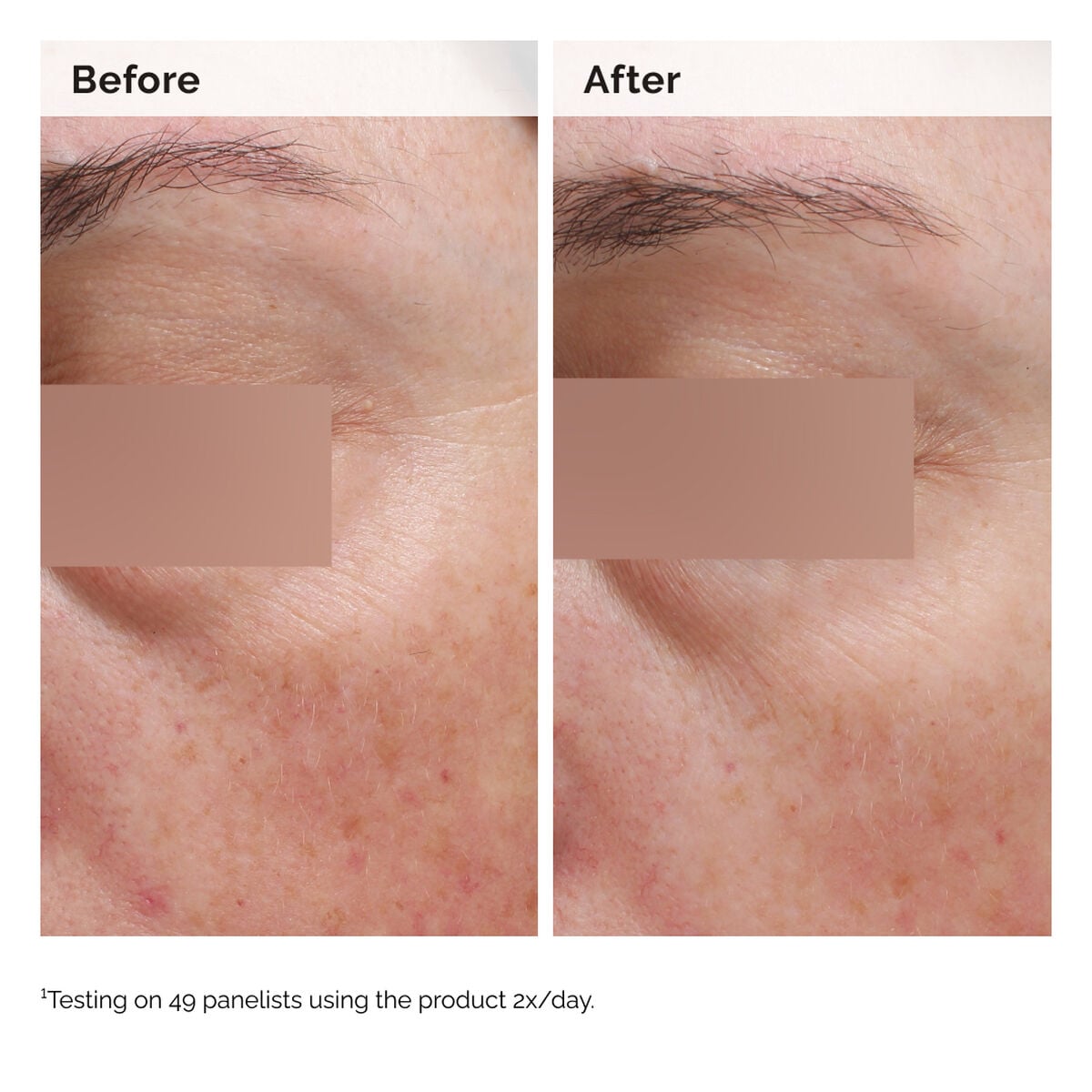 niacinamide-5-face-and-body-emulsion-p6 2024-08-23-ORD-Nia-5pct-Face-Body-B-A-Elasticity-Global-02-1x1.jpg