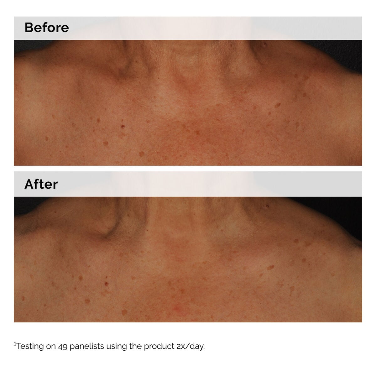 niacinamide-5-face-and-body-emulsion-p6 2024-08-23-ORD-Nia-5pct-Face-Body-B-A-Global-02-1x1.jpg