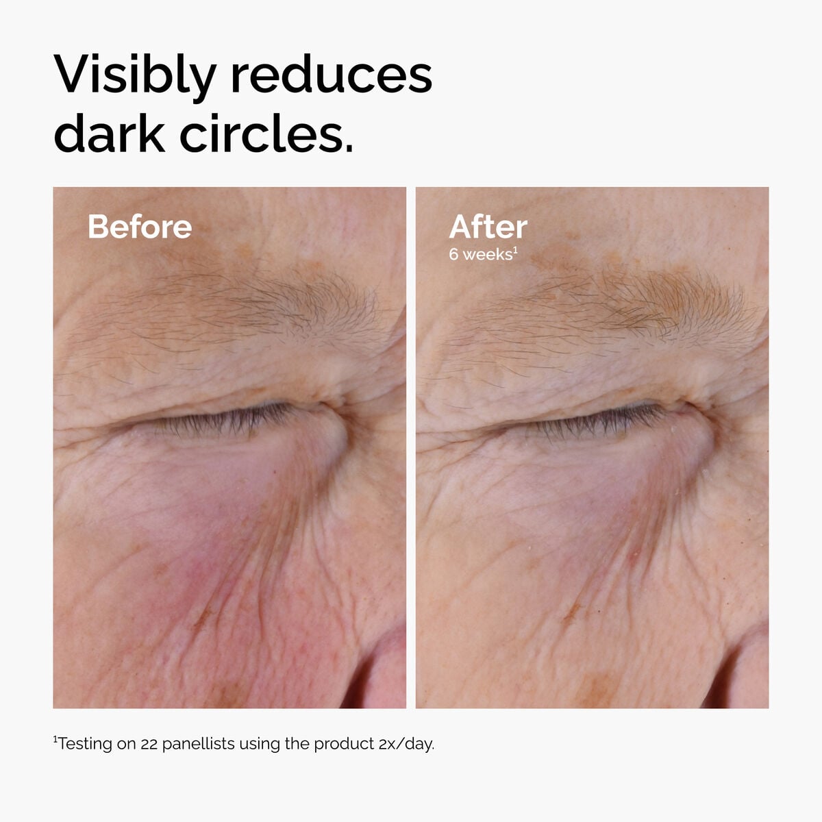 caffeine-solution-5-egcg-eye-serum-k4 ord-caffeine-solution-egcg-dark-circles-before-after.jpg