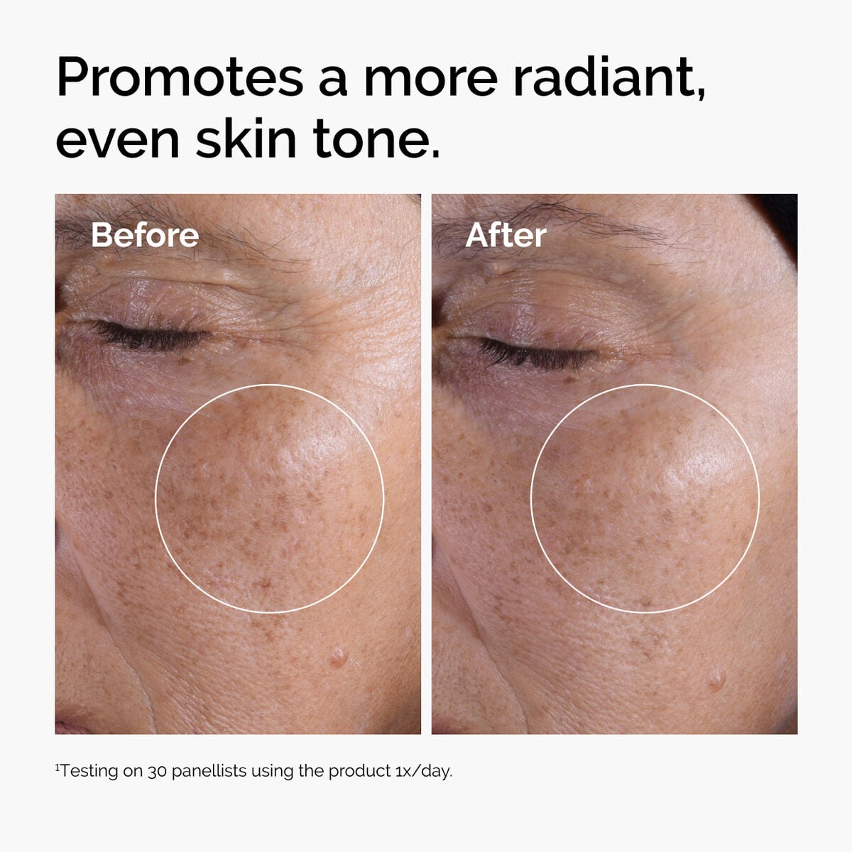 glycolic-acid-7-exfoliating-toner-f5 ord-glycolic-before-after-radiance.jpg