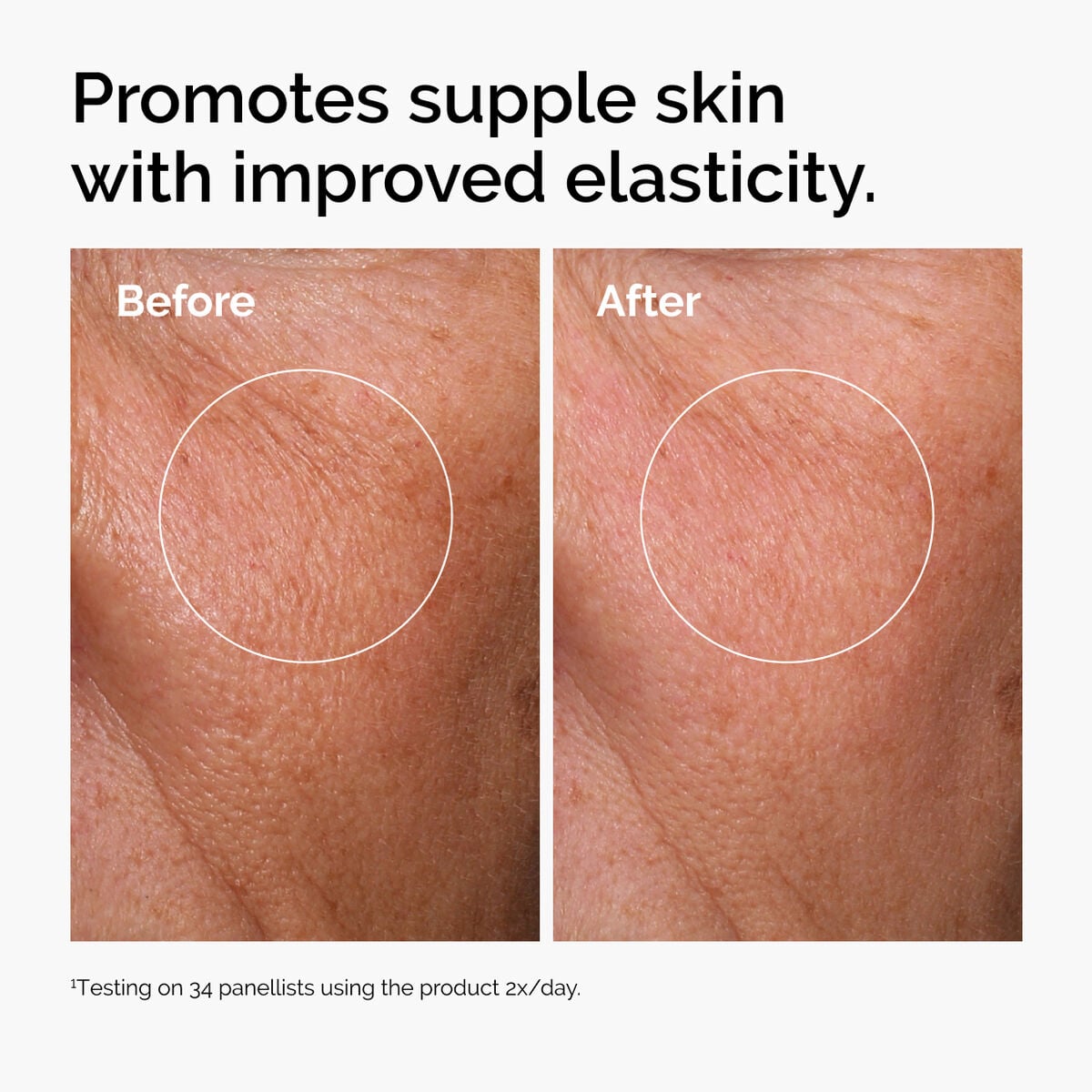 hyaluronic-acid-2-b5-with-ceramides-u3 ord-hyaluronic-acid-2pct-b5-hydrating-serum-before-after-elasticity.jpg
