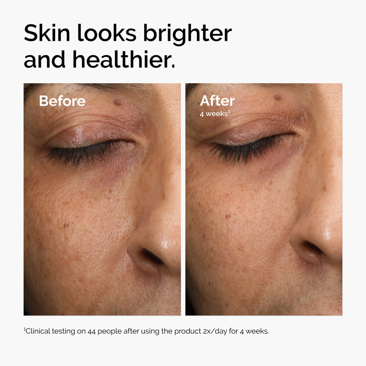 multi-antioxidant-radiance-serum-h0 ord-mars-before-after-healthy.jpg