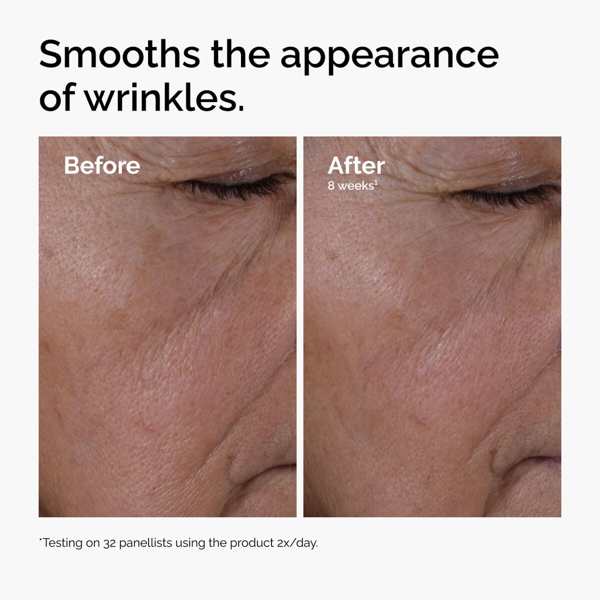 multi-peptide-ha-serum-d2 ord-multi-peptide-ha-serum-wrinkles-before-after.jpg