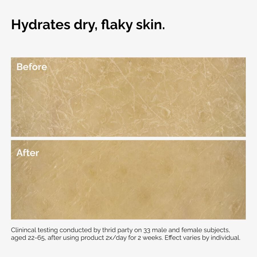 the-body-care-collection-w6 ord-natural-moisturizing-factors-inulin-body-before-after-graphic-02.jpg