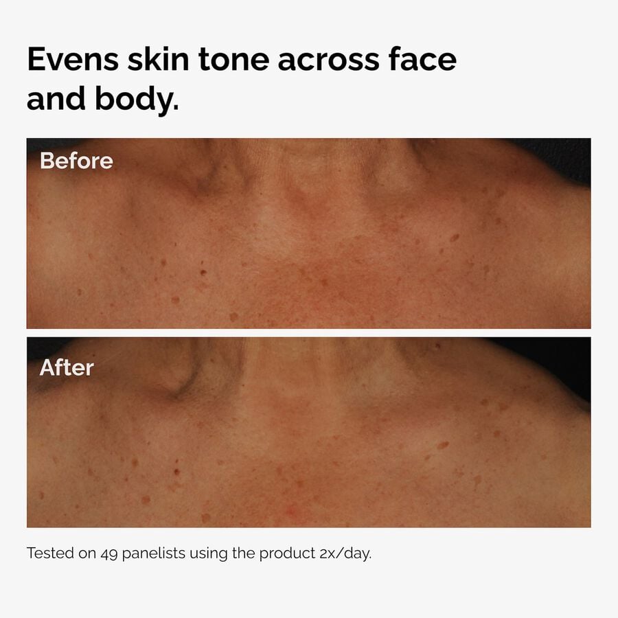 the-body-care-collection-w6 ord-niacinamide-face-body-serum-before-after-even-tone-graphic.jpg