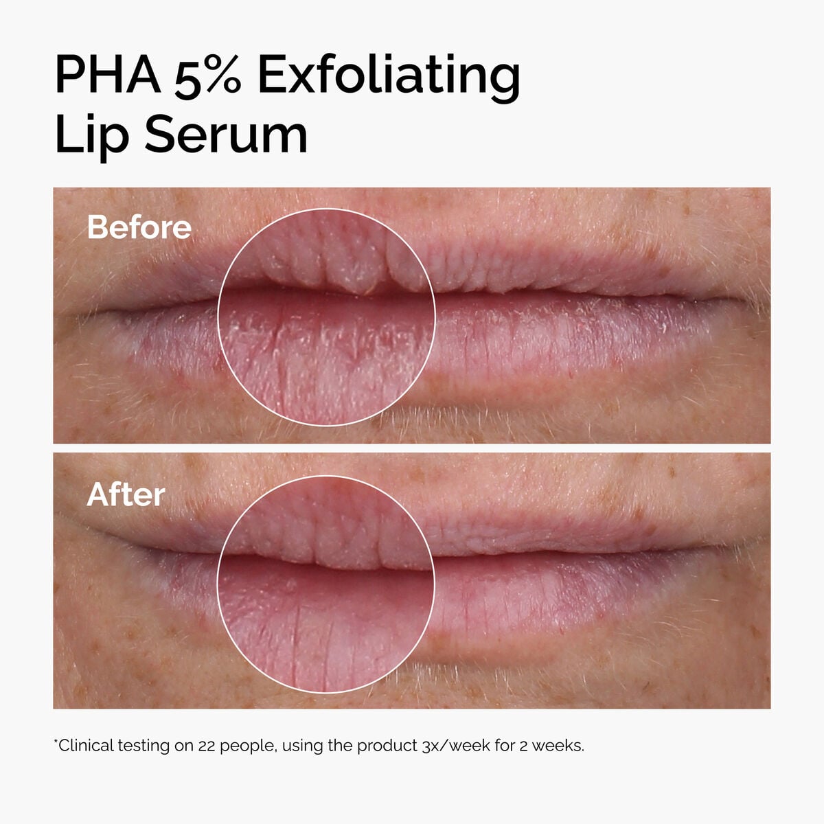 pha-5-exfoliating-lip-serum-l7 ord-pha-5pct-lip-exfoliating-serum-before-after.jpg