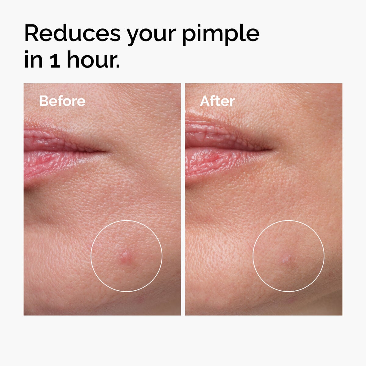 sulfur-10-powder-to-cream-concentrate-w1 ord-sulfur-10pct-powder-to-cream-concentrate-before-after-NA.jpg